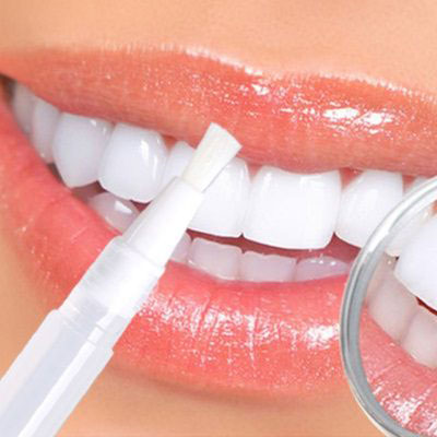 لاک دندان یکی از روش های زیبایی دندان محصوب می شود.