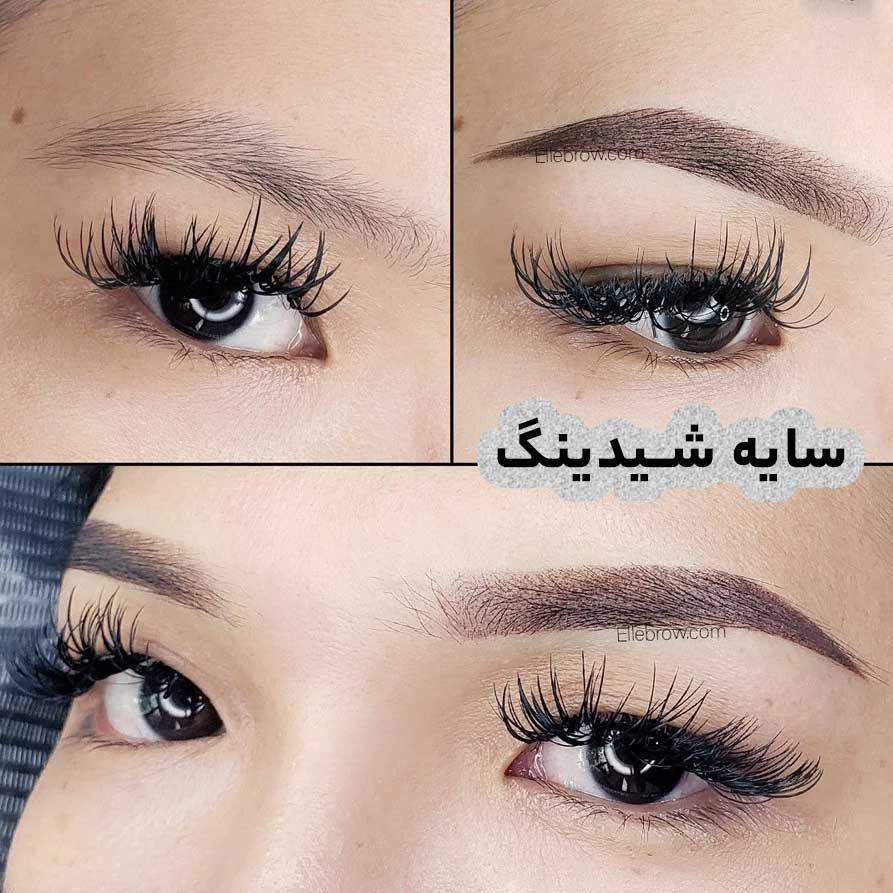 روند ترمیم سایه شیدینگ